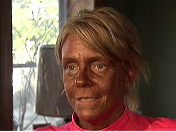 People have become crazy for beauty. “Tan Mom” Charges Dropped